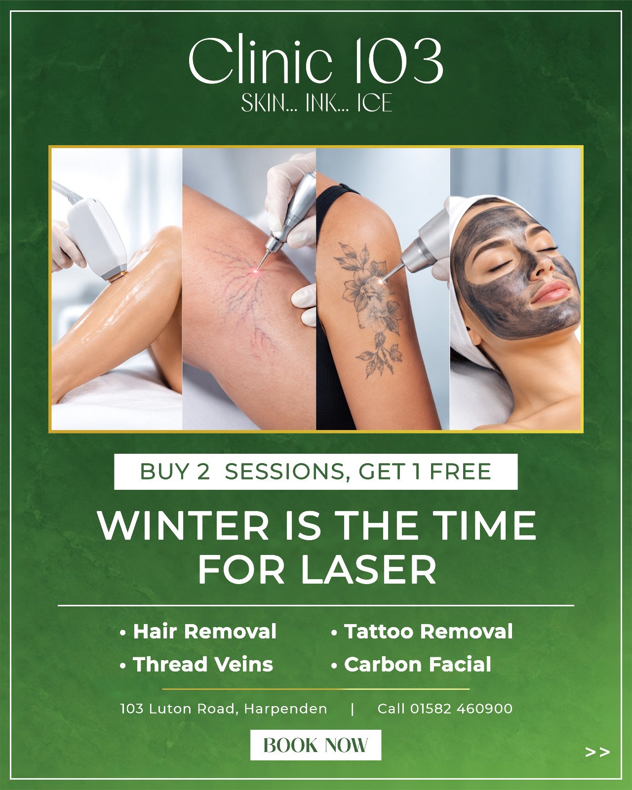 Buy 2 sessions get 1 free laser treatments at Clinic 103 Harpenden — Hair removal, tattoo removal, thread veins, carbon facial